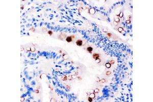 Anti-Estrogen Inducible Protein pS2 antibody, IHC(P) IHC(P): Rat Intestine Tissue (TFF1 anticorps  (Middle Region))