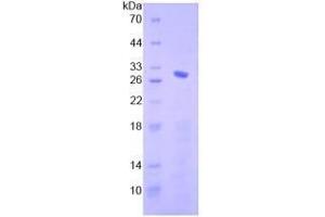 SDS-PAGE analysis of Human Smad4 Protein. (SMAD4 Protéine)