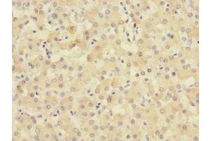 Immunohistochemistry of paraffin-embedded human liver tissue using ABIN7159906 at dilution of 1:100 (TIMM50 anticorps  (AA 87-353))
