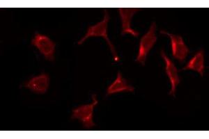 ABIN6269075 staining SK-OV3 by IF/ICC.