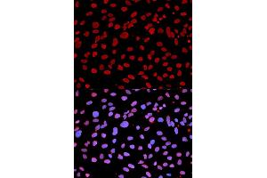Immunofluorescence analysis of U2OS cells using IFIH1 antibody (ABIN5971229). (IFIH1 anticorps)