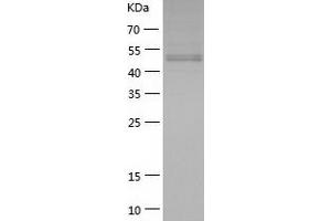 Western Blotting (WB) image for Secretogranin III (SCG3) (AA 20-468) protein (His-IF2DI Tag) (ABIN7125008)
