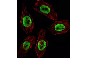 Immunofluorescence (IF) image for anti-Enhancer of Zeste Homolog 2 (EZH2) antibody (ABIN2995316) (EZH2 anticorps)