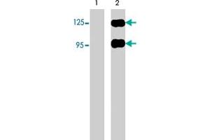 Western blots of neonatal rat brain (lane 1) and human recombinant SEMA3A chimera (95/125 kDa) (lane 2). (SEMA3A anticorps  (N-Term))