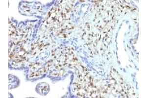 IHC testing of FFPE human placenta with FSP1 antibody (clone S100A4/1481). (s100a4 anticorps)