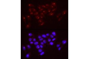 Immunofluorescence analysis of HeLa cells using Nucleolin antibody (ABIN7269035) at dilution of 1:50 (40x lens). (Nucleolin anticorps)