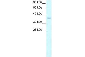 WB Suggested Anti-KLF8 Antibody Titration:  0. (KLF8 anticorps  (Middle Region))