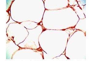 Human visceral white fat tissue was stained by Rabbit Anti-Vaspin (63-104) (Human) Serum
