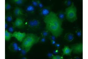 Anti-ACAT2 mouse monoclonal antibody (ABIN2452684) immunofluorescent staining of COS7 cells transiently transfected by pCMV6-ENTRY ACAT2 (RC201821). (ACAT2 anticorps)