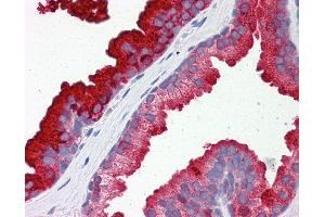 Anti-RAB23 antibody IHC of human prostate. (RAB23 anticorps  (AA 35-84))