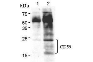 Western Blotting (WB) image for anti-CD59 (CD59) antibody (ABIN1449269) (CD59 anticorps)