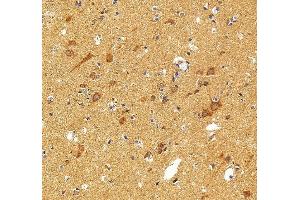 IHC analysis of FATP4/SLC27A4 using anti-FATP4/SLC27A4 antibody (ABIN7600117).