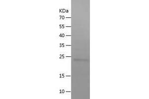 Western Blotting (WB) image for P450 (Cytochrome) Oxidoreductase (POR) (AA 43-226) protein (His tag) (ABIN7124295)