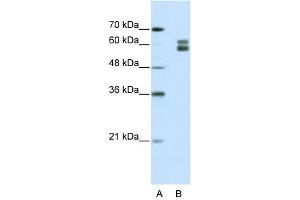 WB Suggested Anti-MSH2 Antibody Titration:  1. (MSH2 anticorps  (N-Term))