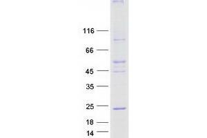 Validation with Western Blot