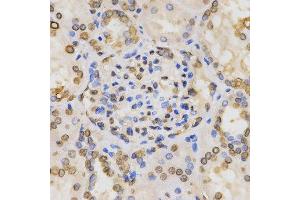 Immunohistochemistry of paraffin-embedded human kidney tissue using H3K36me2 antibody at dilution of 1:200 (x400 lens) (Histone 3 anticorps  (H3K36me2))