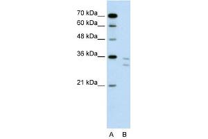 CD8B antibody used at 1 ug/ml to detect target protein. (CD8B anticorps  (N-Term))
