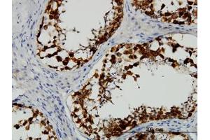 Image no. 1 for anti-Deleted in Azoospermia 1 (DAZ1) (AA 21-121) antibody (ABIN598639) (DAZ1 anticorps  (AA 21-121))