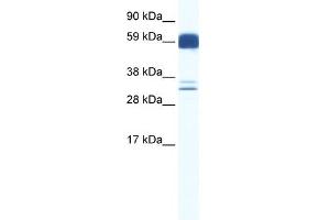 WB Suggested Anti-ZIC5 Antibody Titration:  0. (ZIC5 anticorps  (N-Term))