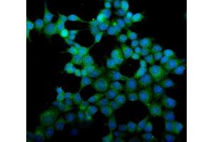 IF analysis of eRF1/ETF1 using anti-eRF1/ETF1 antibody (ABIN7602625). (ETF1 anticorps  (AA 9-342))