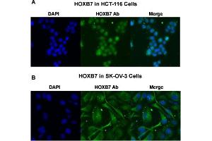 Immunofluorescent staining of (A) HCT-116 and (B) SK-OV-3 cells with HOXB7 polyclonal antibody  under 4 ug/mL working concentration. (HOXB7 anticorps  (AA 168-217))