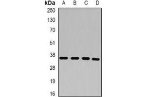 Western blot analysis of p43 expression in HepG2 (A), HT29 (B), MCF7 (C), A549 (D) whole cell lysates. (p43 anticorps)