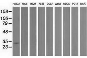 Western blot analysis of extracts (35 µg) from 9 different cell lines by using anti-PECR monoclonal antibody. (PECR anticorps)