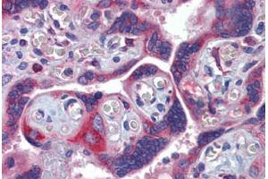 Human Placenta (formalin-fixed, paraffin-embedded) stained with GTPBP10 antibody ABIN462237 followed by biotinylated goat anti-rabbit IgG secondary antibody ABIN481713, alkaline phosphatase-streptavidin and chromogen.