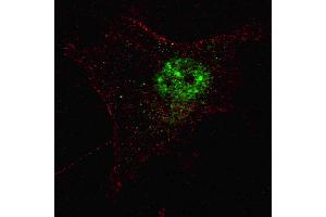 Fluorescent confocal image of SY5Y cells stained with PDX1 (T11) antibody.