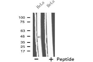 Western blot analysis of extracts from HeLa cells, using IL11RA antibody. (IL11RA anticorps  (C-Term))