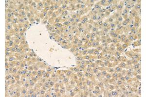 ABIN6257417 and ABIN6275853 at 1/100 staining Rat liver tissue by IHC-P.