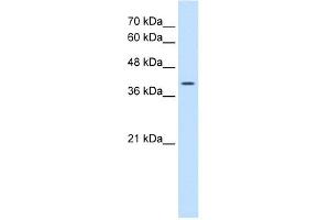WNT2B antibody used at 0.