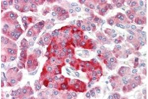 Human Pancreas: Formalin-Fixed, Paraffin-Embedded (FFPE)