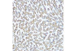 Immunohistochemistry of paraffin-embedded human liver using CPS1 Rabbit mAb (ABIN7266063) at dilution of 1:100 (40x lens). (CPS1 anticorps)