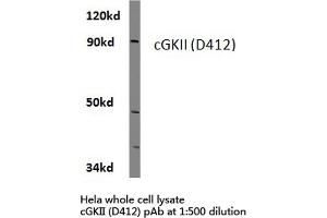 Western blot (WB) analysis of cGKii antibody  in extracts from hela cells.