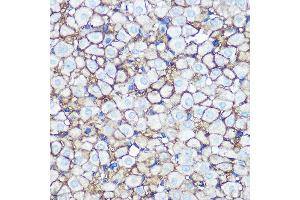 Immunohistochemistry of paraffin-embedded rat ovary using Annexin  Rabbit mAb (ABIN7265619) at dilution of 1:100 (40x lens). (Annexin A2 anticorps)
