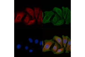 ABIN6263429 and ABIN6266804 staining Hela cells by IF/ICC. (MUC13 anticorps  (C-Term))