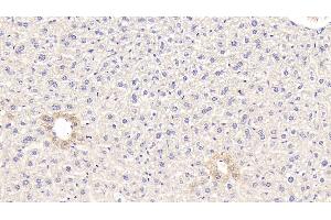 Detection of GCK in Mouse Liver Tissue using Polyclonal Antibody to Glucokinase (GCK) (GCK anticorps  (AA 3-226))