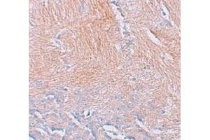 Immunohistochemical staining of human brain cells with CXXC5 polyclonal antibody  at 2.