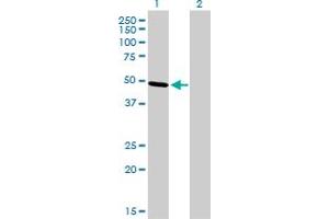 Western Blot analysis of TFAP2B expression in transfected 293T cell line by TFAP2B monoclonal antibody (M01), clone 3G5-1D11.