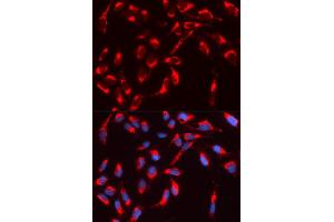 Immunofluorescence (IF) image for anti-Neural Wiskott-Aldrich syndrome protein (WASL) antibody (ABIN1875345) (Neural Wiskott-Aldrich syndrome protein (WASL) anticorps)