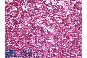 Immunohistochemistry staining of human tonsil (paraffin sections) using anti-CD45RB (clone MEM-143). (CD45RB anticorps)