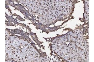 IHC analysis of ANXA4 using anti-ANXA4 antibody (ABIN5518805). (Annexin IV anticorps  (Middle Region))