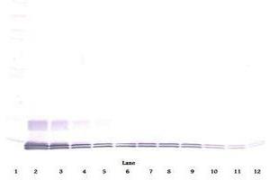 Image no. 1 for anti-Chemokine (C-C Motif) Ligand 7 (CCL7) antibody (ABIN465455) (CCL7 anticorps)