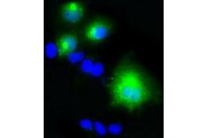 Image no. 3 for anti-Lipase, Endothelial (LIPG) antibody (ABIN1499160)