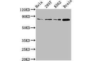 Western Blot Positive WB detected in: Hela whole cell lysate, 293T whole cell lysate, K562 whole cell lysate, Rat brain tissue All lanes: MKLN1 antibody at 2. (MKLN1 anticorps  (AA 488-614))