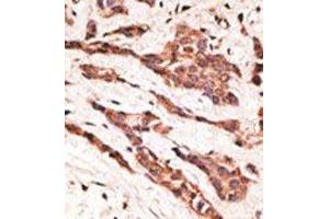 Image no. 1 for anti-Lysophosphatidic Acid Receptor 2 (LPAR2) (N-Term) antibody (ABIN358619) (EDG4 anticorps  (N-Term))