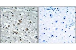 Immunohistochemistry analysis of paraffin-embedded human brain tissue, using GASP1 Antibody. (GPRASP1 anticorps  (AA 741-790))
