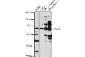 Western blot analysis of extracts of various cell lines, using PGM3 antibody (ABIN7269314) at 1:1000 dilution. (Phosphoglucomutase 3 anticorps  (AA 1-300))