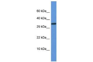 WB Suggested Anti-Vgll2 Antibody Titration: 1. (VGLL2 anticorps  (N-Term))